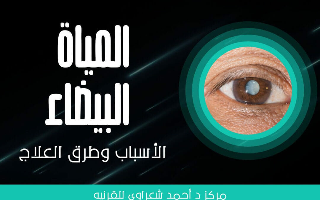 عين | دكتور أحمد شعراوي